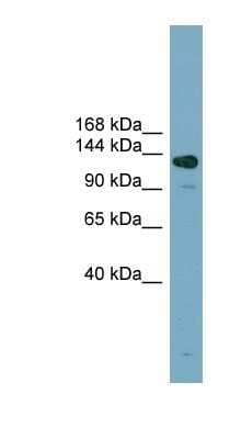 Western Blot: ASXL2 Antibody [NBP1-56576] - NCI-H226 cell lysate, concentration 0.2-1 ug/ml.