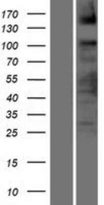 Western Blot ASXL2 Overexpression Lysate