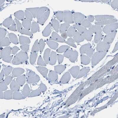 Immunohistochemistry-Paraffin: ASZ1 Antibody [NBP1-89130] - Staining of human skeletal muscle shows low expression as expected.