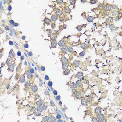 Immunohistochemistry-Paraffin: ASZ1 Antibody [NBP2-92863] - Rat testis using ASZ1 antibody at dilution of 1:100 (40x lens).