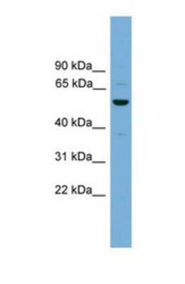 Western Blot: ASZ1 Antibody [NBP1-57071] - THP-1 tissue lysate at a concentration of 1ug/ml.