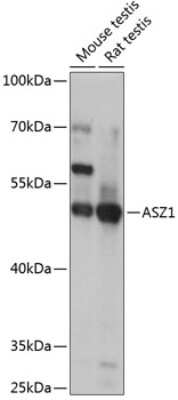 Western Blot: ASZ1 Antibody [NBP2-92863] - Analysis of extracts of various cell lines, using ASZ1 at 1:1000 dilution.Secondary antibody: HRP Goat Anti-Rabbit IgG (H+L) at 1:10000 dilution.Lysates/proteins: 25ug per lane.Blocking buffer: 3% nonfat dry milk in TBST.Detection: ECL Basic Kit .Exposure time: 1s.