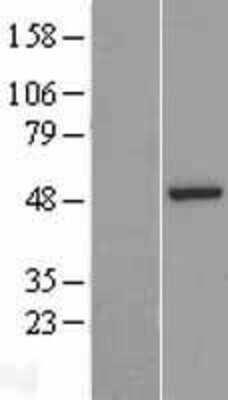 Western Blot: ASZ1 Overexpression Lysate (Adult Normal) [NBP2-05731] Left-Empty vector transfected control cell lysate (HEK293 cell lysate); Right -Over-expression Lysate for ASZ1.