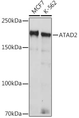 Western Blot: ATAD2 Antibody (2K7T2) [NBP3-15918] - Western blot analysis of extracts of various cell lines, using ATAD2 Rabbit mAb (NBP3-15918) at 1:1000 dilution. Secondary antibody: HRP Goat Anti-Rabbit IgG (H+L) at 1:10000 dilution. Lysates/proteins: 25ug per lane. Blocking buffer: 3% nonfat dry milk in TBST. Detection: ECL Basic Kit. Exposure time: 90s.