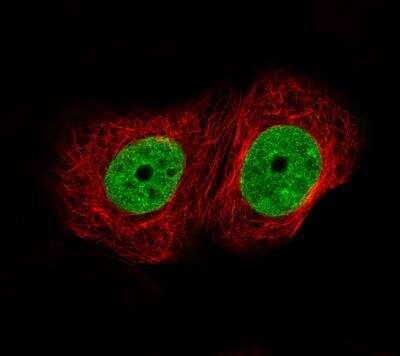 Immunocytochemistry/Immunofluorescence: ATAD2 Antibody (CL0182) [NBP2-14786] - Staining of MCF7 cells using the Anti-ATAD2 monoclonal antibody, showing specific staining in nucleoplasm in green. Microtubule- and nuclear probes are visualized in red and blue, respectively (where available). Antibody staining is shown in green.