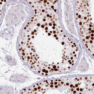Immunohistochemistry-Paraffin: ATAD2 Antibody (CL0182) [NBP2-14786] - Staining of human testis shows moderate to strong nuclear positivity in cells in seminiferous ducts.