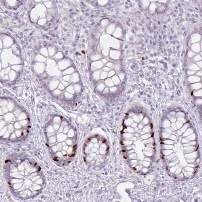 Immunohistochemistry-Paraffin: ATAD2 Antibody (CL0182) [NBP2-14786] - Staining of human rectum shows strong nuclear positivity in  a subset of glandular cells.