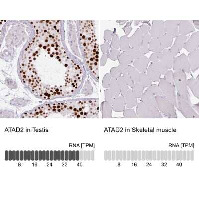 Immunohistochemistry-Paraffin: ATAD2 Antibody (CL0182) [NBP2-14786] - Staining in human testis and skeletal muscle tissues. Corresponding ATAD2 RNA-seq data are presented for the same tissues.