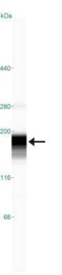 Simple Western: ATAD2 Antibody (CL0182) [NBP2-14786] - Simple Western lane view shows a specific band for  ATAD2 in 0.2 mg/ml of U-251MG sp lysate.  This experiment was performed under reducing conditions using the 66-440 kDa separation system.