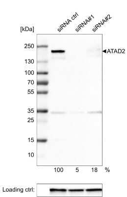 <b>Genetic Strategies Validation and Orthogonal Strategies Validation.</b>Western Blot: ATAD2 Antibody (CL0182) [NBP2-14786] - Analysis in U-251MG cells transfected with control siRNA, target specific siRNA probe #1 and #2, using Anti-ATAD2 antibody. Remaining relative intensity is presented. Loading control: Anti-GAPDH.