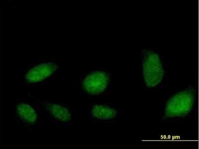 Immunocytochemistry/Immunofluorescence: ATAD2 Antibody [H00029028-B01P] - Analysis of purified antibody to ATAD2 on HeLa cell. (antibody concentration 10 ug/ml)