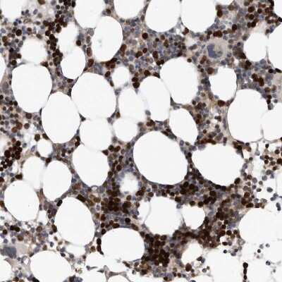 Immunohistochemistry-Paraffin: ATAD2 Antibody [NBP1-84123] - Staining of human Bone marrow shows strong nuclear positivity in hematopoietic cells.