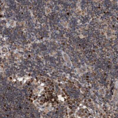Immunohistochemistry-Paraffin: ATAD2 Antibody [NBP1-84123] - Staining of human Lymph node shows moderate nuclear positivity in non-germinal center cells.