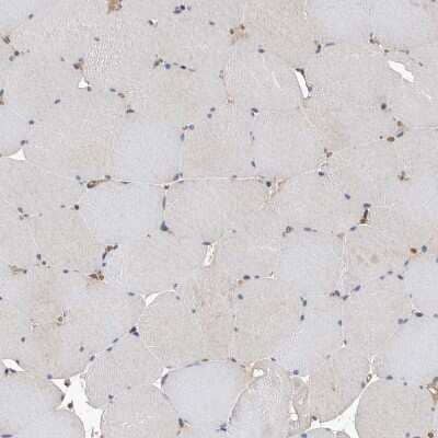 Immunohistochemistry-Paraffin: ATAD2 Antibody [NBP1-84123] - Staining of human Skeletal muscle shows very weak positivity in myocytes.