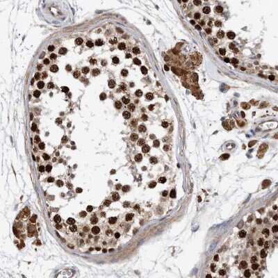 Immunohistochemistry-Paraffin: ATAD2 Antibody [NBP1-84123] - Staining of human Testis shows strong nuclear positivity in cells in seminiferous ducts.