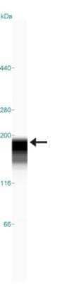 Simple Western: ATAD2 Antibody [NBP1-84123] - Simple Western lane view shows a specific band for  ATAD2 in 0.2 mg/ml of U-251MG sp lysate.  This experiment was performed under reducing conditions using the 66-440 kDa separation system.