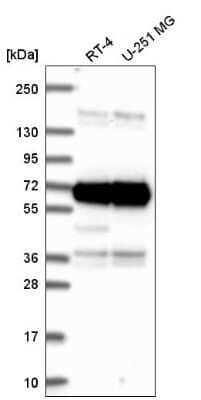 Western Blot: ATAD3A Antibody [NBP2-57335] - Western blot analysis in human cell line RT-4 and human cell line U-251 MG.
