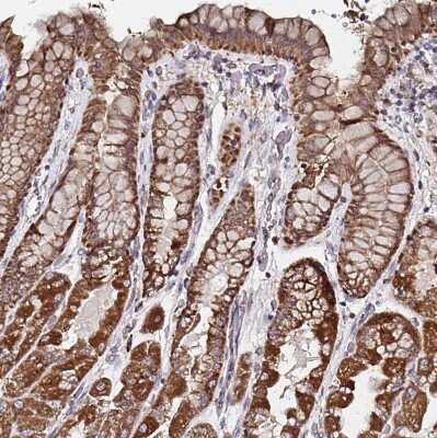 Immunohistochemistry-Paraffin: ATAD3B Antibody [NBP2-32409] - Staining of human stomach shows strong granular cytoplasmic positivity in glandular cells.
