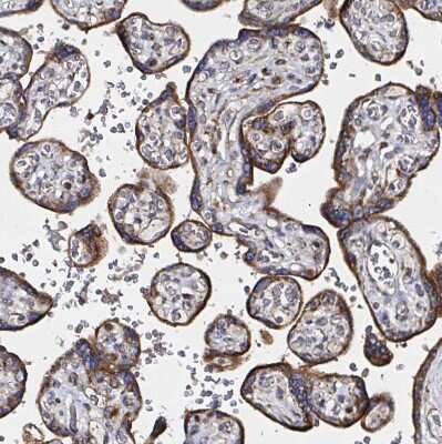 Immunohistochemistry-Paraffin: ATAD3B Antibody [NBP2-32409] - Staining of human placenta shows strong granular cytoplasmic positivity in trophoblastic cells.