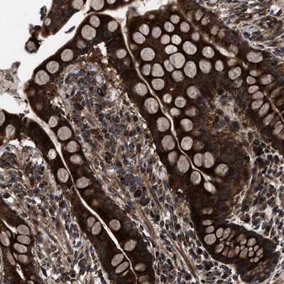 Immunohistochemistry-Paraffin: ATAD4 Antibody [NBP1-90075] - Staining of human colon shows strong cytoplasmic positivity in glandular cells.