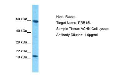 Western Blot ATAD4 Antibody - BSA Free