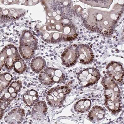 Immunohistochemistry-Paraffin: ATBF1/ZFHX3 Antibody [NBP2-34126] - Staining of human duodenum shows strong nuclear positivity in glandular cells.