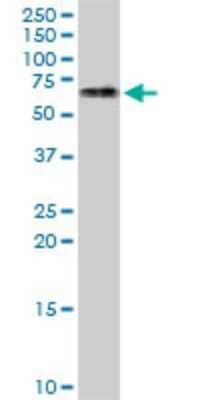 Western Blot: ATCAY Antibody (4F2) [H00085300-M07] - Analysis of ATCAY expression in IMR-32 (Cat # L008V1).