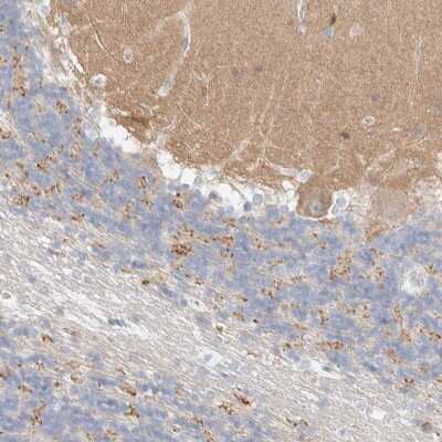 Immunohistochemistry: ATCAY Antibody [NBP2-48537] - Staining of human cerebellum shows moderate cytoplasmic positivity in subsets of cells.