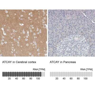 Immunohistochemistry-Paraffin: ATCAY Antibody [NBP2-48537] - Staining in human cerebral cortex and pancreas tissues using anti-ATCAY antibody. Corresponding ATCAY RNA-seq data are presented for the same tissues.