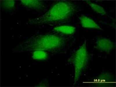 Immunocytochemistry/Immunofluorescence: ATE1 Antibody (2B6) [H00011101-M01] - Analysis of monoclonal antibody to ATE1 on HeLa cell . Antibody concentration 10 ug/ml.