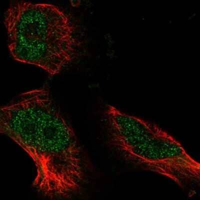 Immunocytochemistry/Immunofluorescence: ATE1 Antibody [NBP2-55688] - Staining of human cell line U-251 MG shows localization to nucleus.