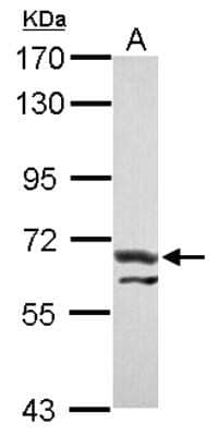 Western Blot: ATE1 Antibody [NBP2-15495] - Sample (30 ug of whole cell lysate) A: Jurkat 7. 5% SDS PAGE gel, diluted at 1:3000.