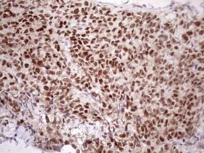 Immunohistochemistry ATF1 Antibody (OTI2B4) - Azide and BSA Free