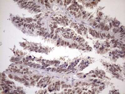Immunohistochemistry ATF1 Antibody (OTI2B4) - Azide and BSA Free