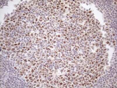 Immunohistochemistry ATF1 Antibody (OTI2B4) - Azide and BSA Free
