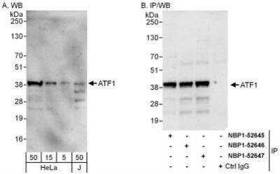 <b>Independent Antibodies Validation and Biological Strategies Validation.</b>Western Blot: ATF1 Antibody [NBP1-52647] - Whole cell lysate from HeLa (5, 15 and 50 mcg for WB; 1 mg for IP, 20% of IP loaded) and Jurkat (J; 50 mcg) cells.  Affinity purified rabbit anti-ATF1 antibody used for WB at 0.04 mcg/ml (A) and 0.4 mcg/ml (B) and used for IP at 6 mcg/mg lysate.  ATF1 was also immunoprecipitated by rabbit anti-ATF1 antibodies NBP1-52645 and NBP1-52646, which recognize upstream epitopes.