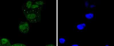 Immunocytochemistry/Immunofluorescence: ATF2 Antibody (SZ17-01) [NBP2-67354] - Staining ATF2 in Hela cells (green). The nuclear counter stain is DAPI (blue). Cells were fixed in paraformaldehyde, permeabilised with 0.25% Triton X100/PBS.