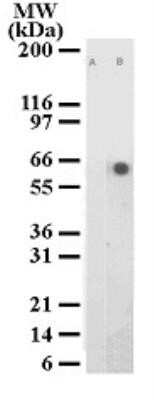 Western Blot: ATF2 [p Thr71] Antibody (103C411.2) - Azide Free [NBP2-33236] - Detection of ATF2 phosphorylation in HeLa cell lysate with phospho ATF2 antibody. Lane A. Untreated cell lysate; Lane B. HeLa cells treated with TNF for 1 hr. Image from the standard format of this antibody.