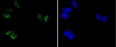 Immunocytochemistry/Immunofluorescence: ATF2 [p Thr71] Antibody (SC05-90) [NBP2-67573] - Staining phospho-ATF2(T71) in Hela cells (green). The nuclear counter stain is DAPI (blue). Cells were fixed in paraformaldehyde, permeabilised with 0.25% Triton X100/PBS.