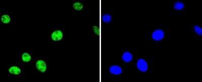 Immunocytochemistry/Immunofluorescence: ATF2 [p Thr71] Antibody (SC05-90) [NBP2-67573] - LRP-1 Cluster III [p Thr71] Antibody (SC05-90) [NBP2-67573] - (T71) in SH-SY-5Y cells (green). The nuclear counter stain is DAPI (blue). Cells were fixed in paraformaldehyde, permeabilised with 0.25% Triton X100/PBS.