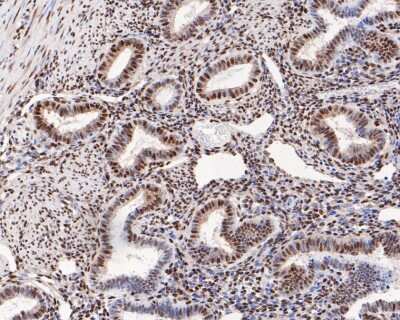 Immunohistochemistry-Paraffin: ATF2 [p Thr71] Antibody (SC05-90) [NBP2-67573] - Immunohistochemical analysis of paraffin-embedded human uterus tissue using anti-ATF2 antibody. The section was pre-treated using heat mediated antigen retrieval with sodium citrate buffer (pH 6.0) for 20 minutes. The tissues were blocked in 5% BSA for 30 minutes at room temperature, washed with ddH2O and PBS, and then probed with the primary antibody (ET1610-30, 1/200) for 30 minutes at room temperature. The detection was performed using an HRP conjugated compact polymer system. DAB was used as the chromogen. Tissues were counterstained with hematoxylin and mounted with DPX.