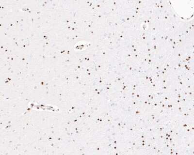 Immunohistochemistry-Paraffin: ATF2 [p Thr71] Antibody (SC05-90) [NBP2-67573] - Immunohistochemical analysis of paraffin-embedded rat brain tissue using anti-ATF2 antibody. The section was pre-treated using heat mediated antigen retrieval with sodium citrate buffer (pH 6.0) for 20 minutes. The tissues were blocked in 5% BSA for 30 minutes at room temperature, washed with ddH2O and PBS, and then probed with the primary antibody (ET1610-30, 1/200) for 30 minutes at room temperature. The detection was performed using an HRP conjugated compact polymer system. DAB was used as the chromogen. Tissues were counterstained with hematoxylin and mounted with DPX.