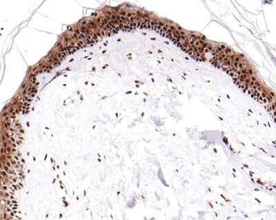 Immunohistochemistry-Paraffin: ATF2 [p Thr71] Antibody (SC05-90) [NBP2-67573] - Analysis of paraffin-embedded human skin tissue with Rabbit anti-ATF2 [p Thr71] antibody washed with ddH2O and PBS, and then probed with the primary antibody  at 1/200 dilution for 1 hour at room temperature. The detection was performed using an HRP conjugated compact polymer system. DAB was used as the chromogen. Tissues were counterstained with hematoxylin and mounted with DPX.