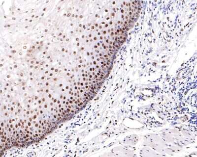 Immunohistochemistry-Paraffin: ATF2 [p Thr71] Antibody (SC05-90) [NBP2-67573] - Analysis of paraffin-embedded human esophagus tissue with Rabbit anti-ATF2[p Thr71] antibody washed with ddH2O and PBS, and then probed with the primary antibody  at 1/200 dilution for 1 hour at room temperature. The detection was performed using an HRP conjugated compact polymer system. DAB was used as the chromogen. Tissues were counterstained with hematoxylin and mounted with DPX.