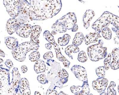 Immunohistochemistry-Paraffin: ATF2 [p Thr71] Antibody (SC05-90) [NBP2-67573] - Analysis of paraffin-embedded human placenta tissue with Rabbit anti-ATF2 [p Thr71] antibody washed with ddH2O and PBS, and then probed with the primary antibody at 1/200 dilution for 1 hour at room temperature. The detection was performed using an HRP conjugated compact polymer system. DAB was used as the chromogen. Tissues were counterstained with hematoxylin and mounted with DPX.