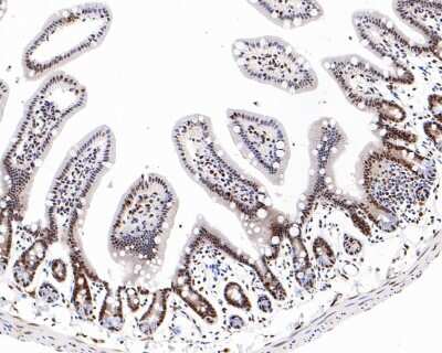 Immunohistochemistry-Paraffin: ATF2 [p Thr71] Antibody (SC05-90) [NBP2-67573] - Analysis of paraffin-embedded mouse large intestine tissue with Rabbit anti-Phospho-ATF2 [p Thr71] antibody washed with ddH2O and PBS, and then probed with the primary antibody  at 1/800 dilution for 1 hour at room temperature. The detection was performed using an HRP conjugated compact polymer system. DAB was used as the chromogen. Tissues were counterstained with hematoxylin and mounted with DPX.