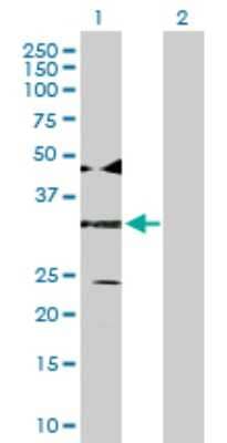 Western Blot: ATF4 Antibody [H00000468-D01P] - Analysis of ATF4 expression in transfected 293T cell line by ATF4 polyclonal antibody.Lane 1: ATF4 transfected lysate(38.60 KDa).Lane 2: Non-transfected lysate.