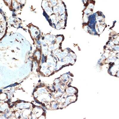 Immunohistochemistry-Paraffin: ATF5 Antibody (9Z3M0) [NBP3-16221] - Immunohistochemistry of paraffin-embedded human placenta using ATF5 Rabbit mAb (NBP3-16221) at dilution of 1:100 (40x lens).Perform microwave antigen retrieval with 10 mM Tris/EDTA buffer pH 9.0 before commencing with IHC staining protocol.