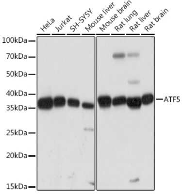 Western Blot: ATF5 Antibody (9Z3M0) [NBP3-16221] - Western blot analysis of extracts of various cell lines, using ATF5 Rabbit mAb (NBP3-16221) at 1:1000 dilution. Secondary antibody: HRP Goat Anti-Rabbit IgG (H+L) at 1:10000 dilution. Lysates/proteins: 25ug per lane. Blocking buffer: 3% nonfat dry milk in TBST. Detection: ECL Basic Kit. Exposure time: 3s.