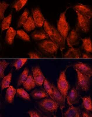 Immunocytochemistry/Immunofluorescence: ATF5 Antibody [NBP2-92397] - Analysis of C6 cells using ATF5 at dilution of 1:100. Blue: DAPI for nuclear staining.